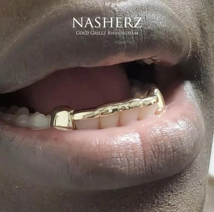 London Bridge - Nasherz Gold Grillz