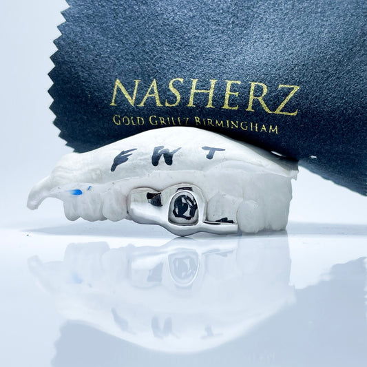 Incisivo lateral, ventana y punta